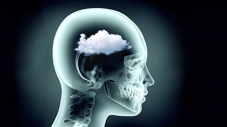 Uzmanlara göre beyin sisi gerçekte nedir?